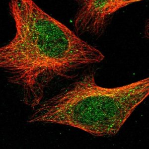 Anti-DPH3 antibody produced in rabbit 