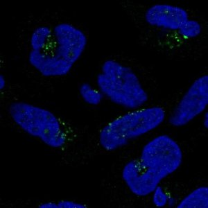 Anti-DPH5 antibody produced in rabbit 