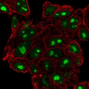 Anti-DPH6 antibody produced in rabbit 