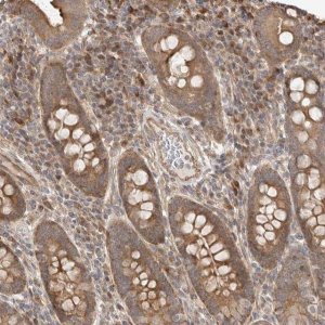 Anti-DPH7 antibody produced in rabbit 