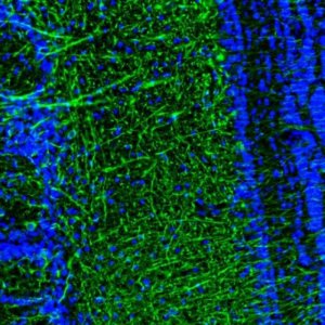 Anti-DPP6 antibody produced in rabbit HPA050509-100UL