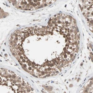 Anti-DPP8 antibody produced in rabbit 