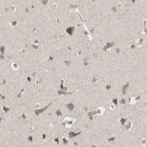 Anti-DPP8 antibody produced in rabbit 