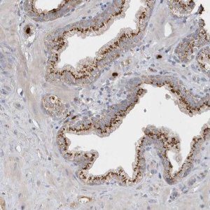 Anti-DPP9 antibody produced in rabbit 