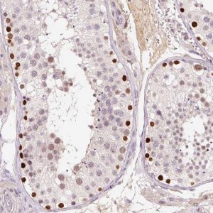 Anti-DPPA4 antibody produced in rabbit 
