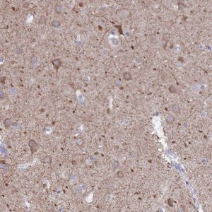 Anti-DPYD antibody produced in rabbit 