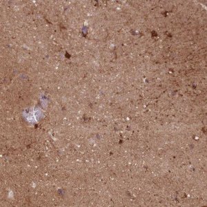 Anti-DPYSL4 antibody produced in rabbit HPA049066-100UL
