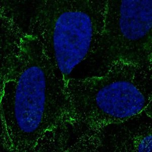 Anti-DSC3 antibody produced in rabbit 