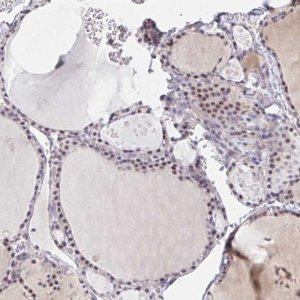 Anti-DSCAML1 antibody produced in rabbit 