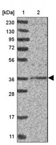Anti-DSCC1 antibody produced in rabbit HPA023780-100UL