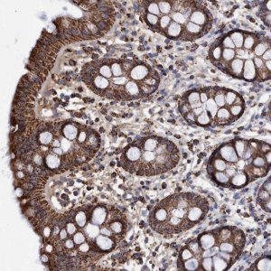 Anti-DSCR3 antibody produced in rabbit 