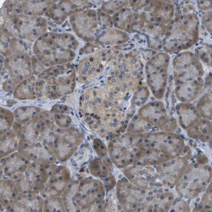 Anti-DSE antibody produced in rabbit 