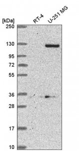 Anti-DSEL antibody produced in rabbit HPA060942-100UL