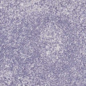 Anti-DSG4 antibody produced in rabbit 
