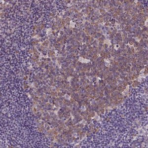 Anti-DTX1 antibody produced in rabbit 