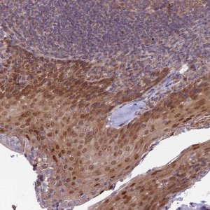 Anti-DTX2 antibody produced in rabbit 