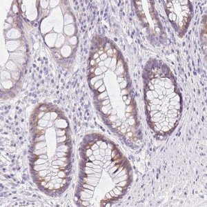 Anti-DTX4 antibody produced in rabbit 
