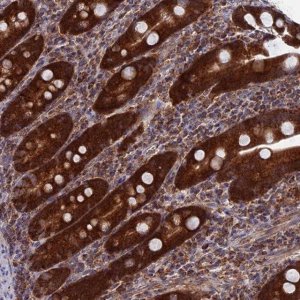 Anti-DTYMK antibody produced in rabbit 