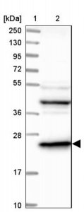 Anti-DTYMK antibody produced in rabbit 