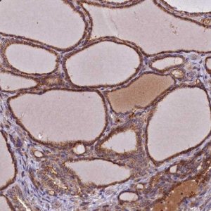 Anti-DUOXA1 antibody produced in rabbit 