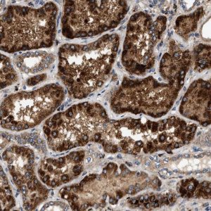 Anti-DUSP10 antibody produced in rabbit 