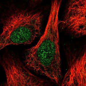Anti-DUSP16 antibody produced in rabbit 