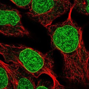 Anti-DUSP2 antibody produced in rabbit 