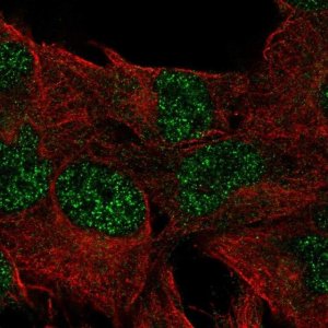 Anti-DUSP23 antibody produced in rabbit 
