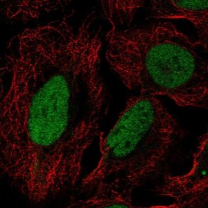 Anti-DUSP27 antibody produced in rabbit 