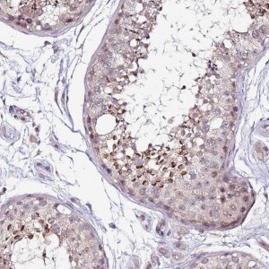 Anti-DUSP28 antibody produced in rabbit 