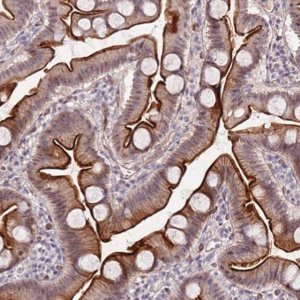 Anti-DUSP28 antibody produced in rabbit 