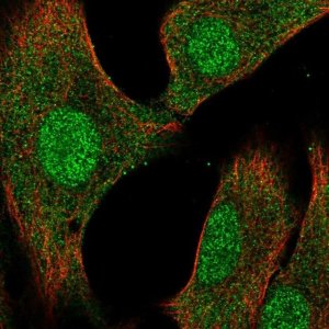Anti-DUSP3 antibody produced in rabbit 