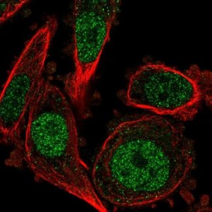 Anti-DUSP4 antibody produced in rabbit 