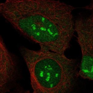Anti-DUX4 antibody produced in rabbit 