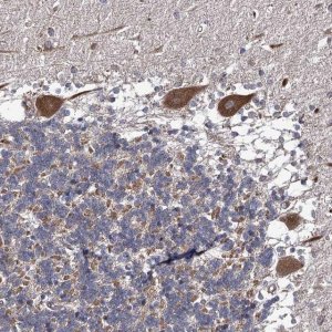 Anti-DYDC1 antibody produced in rabbit 