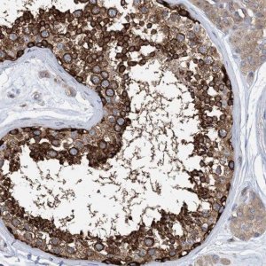 Anti-DYNC1LI1 antibody produced in rabbit 