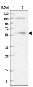 Anti-DYNC1LI1 antibody produced in rabbit 