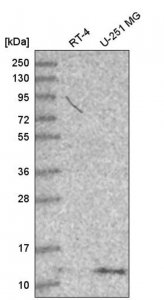 Anti-DYNLT1 antibody produced in rabbit HPA046559-100UL