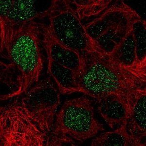 Anti-E2F8 antibody produced in rabbit 