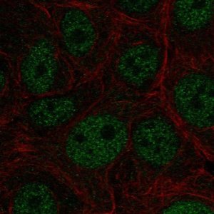 Anti-E4F1 antibody produced in rabbit 