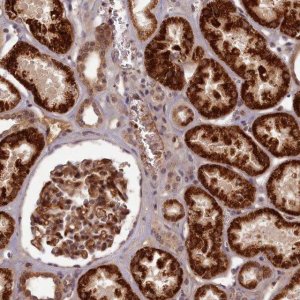 Anti-EARS2 antibody produced in rabbit 
