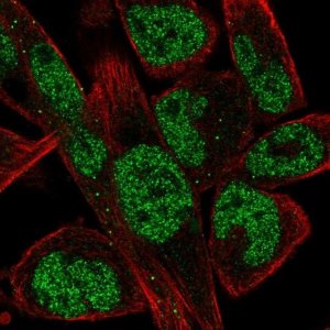 Anti-EBF1 antibody produced in rabbit 