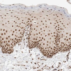 Anti-EBNA1BP2 antibody produced in rabbit 