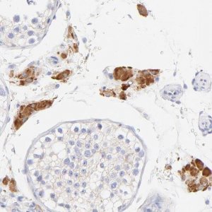 Anti-EBP antibody produced in rabbit 