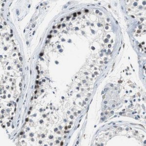 Anti-ECD antibody produced in rabbit 