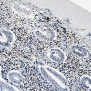Anti-ECD antibody produced in rabbit 
