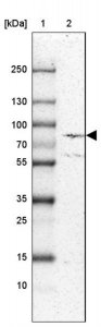Anti-ECE1 antibody produced in rabbit HPA001490-100UL