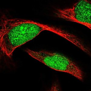 Anti-ECE2 antibody produced in rabbit 