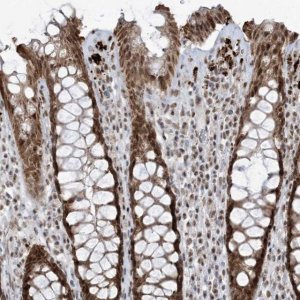 Anti-ECT2L antibody produced in rabbit 