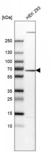Anti-EDC3 antibody produced in rabbit 